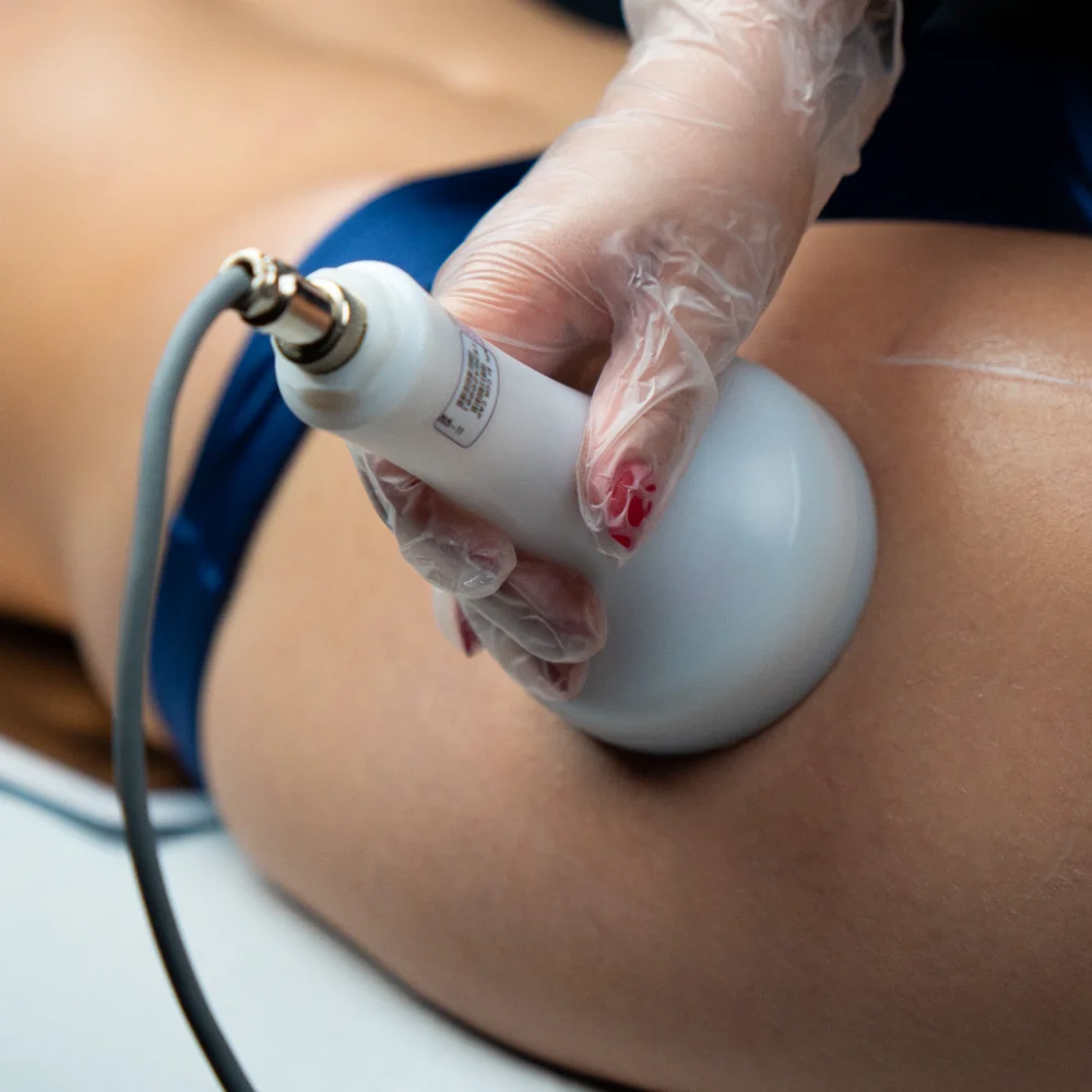 Tratamento corporal com equipamento IBRAMED